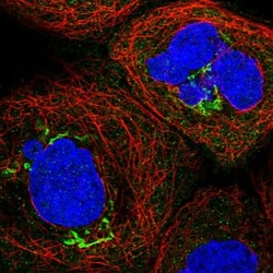 CCDC68 Antibody, Novus Biologicals 25 &mu;L; Unlabeled:Antibodies, Polyclonal